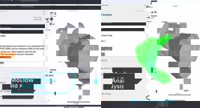 2.0 Mould Flow Analysis