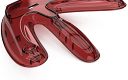 Design Considerations for the Cosmetics of Injection-Moulded Plastic Parts