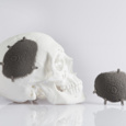 Novax DMA cranial implant built by Protolabs